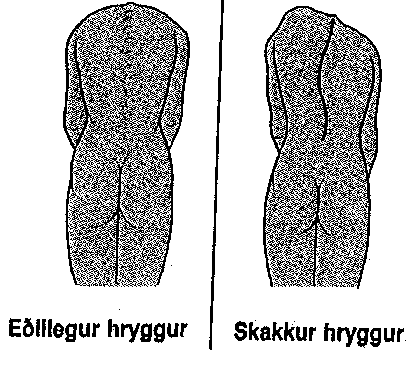 hryggskekkja: 