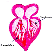 Hjarta: 