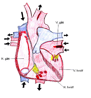 Hjarta: