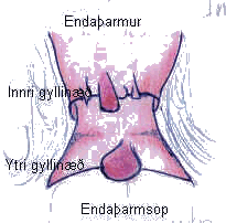 Gyllinæð: 